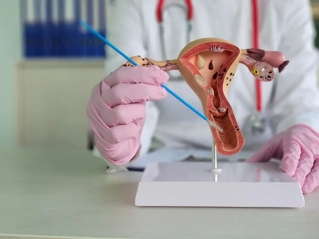 Jakie konsekwencje przynosi nieleczenie mięśniaków macicy